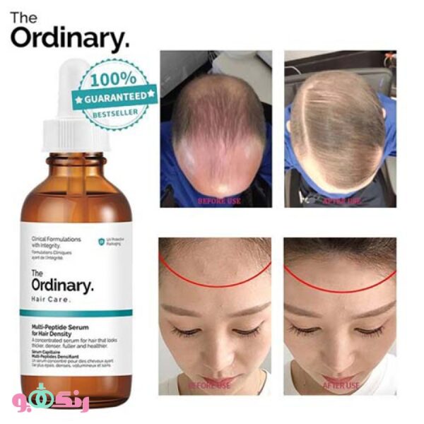 Ordinary multi peptide anti hair loss serum 60 ml 6