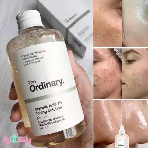 the ordinary direct acids toning solution 2